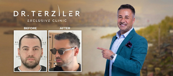 Press Release thumbnail